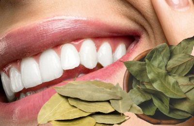 দাঁত ঝকঝকে করবে তেজপাতা